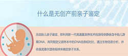 在舟山群岛新区怀孕期间如何做孕期亲子鉴定，在舟山群岛新区怀孕了办理亲子鉴定准确可靠吗